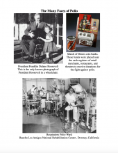 Many Faces of Polio